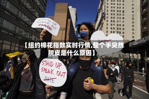 【纽约棉花指数实时行情,整个手突然脱皮是什么原因】-第2张图片