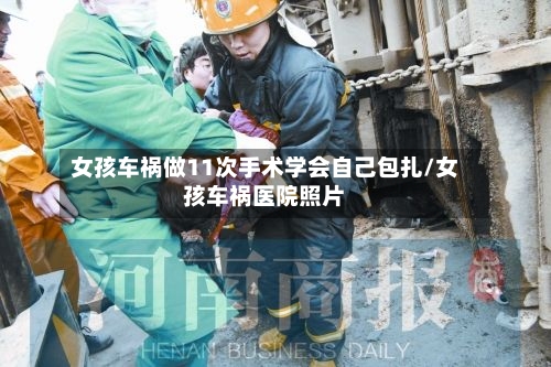 女孩车祸做11次手术学会自己包扎/女孩车祸医院照片-第3张图片