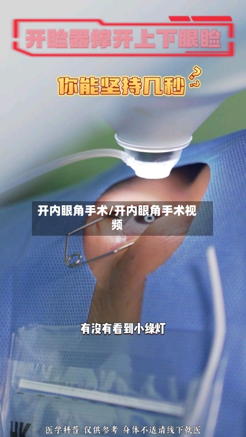开内眼角手术/开内眼角手术视频-第2张图片